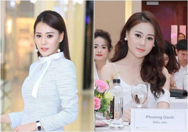 Hình ảnh Phương Oanh trước và sau khi phẫu thuật thẩm mỹ