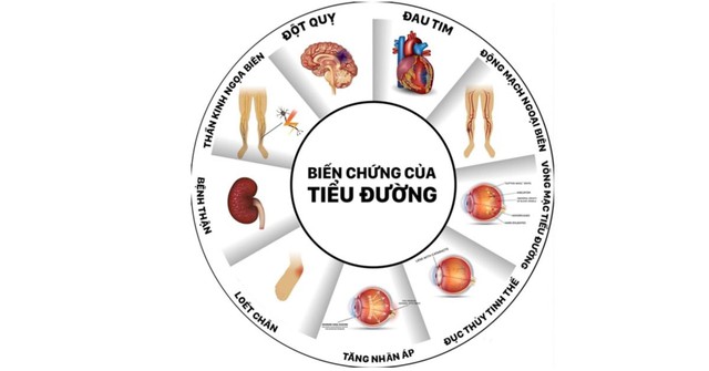 
Những biến chứng tiểu đường bạn nên biết (Nguồn: Internet)
