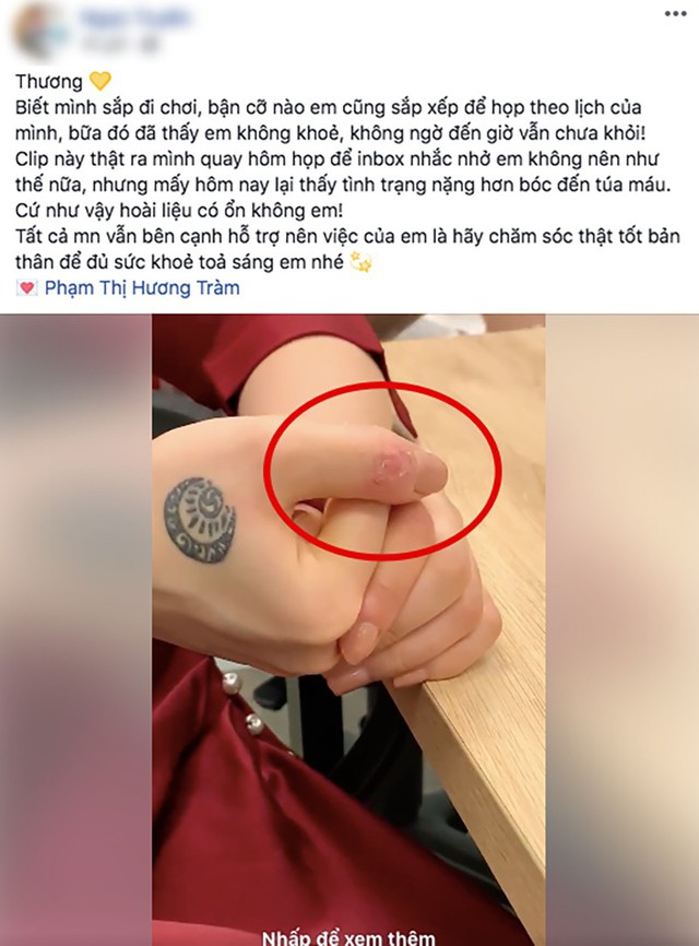 Lời chia sẻ của bạn về t&igrave;nh trạng của nữ ca sĩ