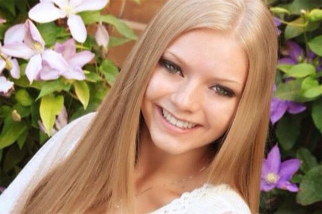 
Samantha Scott, 23 tuổi, mất ngày 27 tháng 10 do mắc hội chứng Lemierre hiếm gặp.
