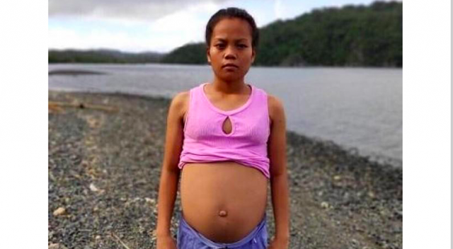 Kimberly Robles với cái bụng to lớn bất thường. Ảnh: GMA News