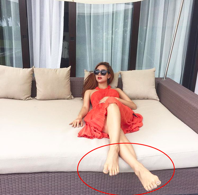 Ngay cả khi chân trần hay thoải mái với những đôi giày bệt Minh Hằng cũng để lộ nhược điểm này, chứ chưa nói đến mỗi lần xỏ chân trong những đôi cao gót lênh khênh.