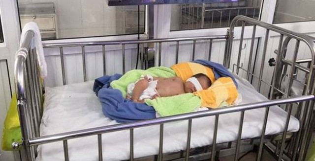 
Bé gái đang được chăm sóc tại Bệnh viện Sản Nghi Nghệ An.
