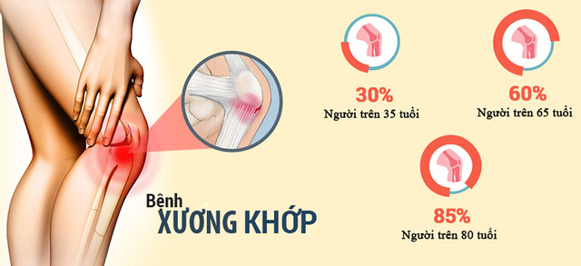 
Tỷ lệ người già bị mắc các bệnh xương khớp
