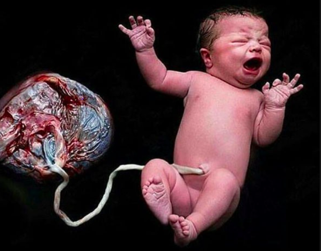 
Một em bé chào đời ra khỏi bụng mẹ phải được đảm bảo về chỉ số sống rất cao (trí tuệ, thể chất...)
