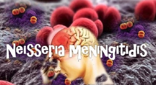 Vi khuẩn Neisseria Meningitidis gây viêm não mô cầu.