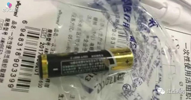 Cục pin nằm trong bụng b&eacute; g&aacute;i Vi Vi.