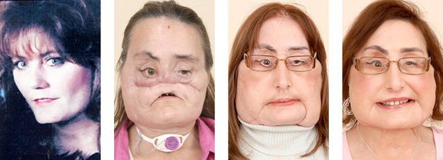 Sau 4 năm d&agrave;i đau đớn, Connie đ&atilde; được t&aacute;i sinh với một gương mặt mới.