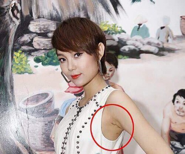 Bé Heo Minh Hằng cũng từng bị soi vì xuất hiện vết sẹo lạ dưới cánh tay. (Ảnh: Internet)