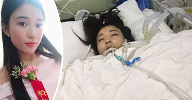 Min xinh xắn khi làm phù dâu (bìa trái) và tình trạng hiện tại của cô trong bệnh viện (bìa phải).