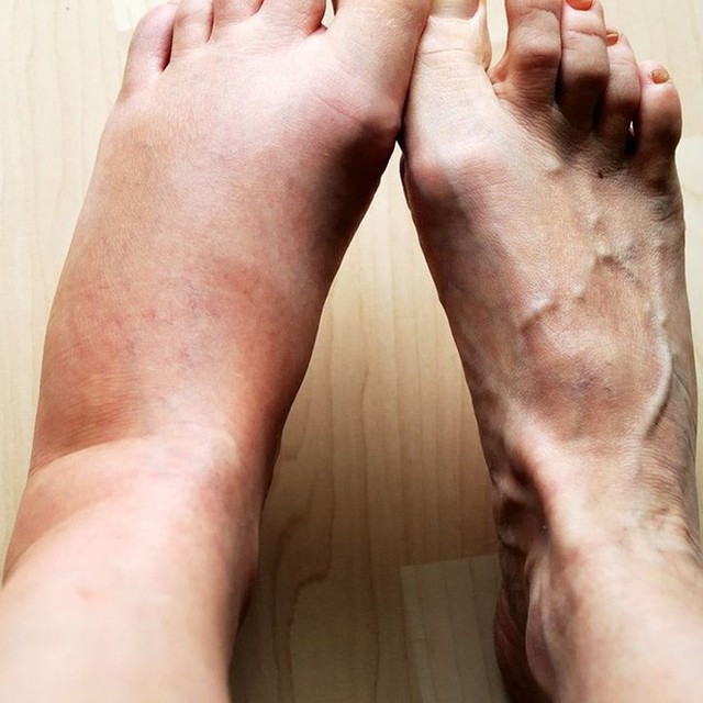 10. Dịch tiết &acirc;m đạo bất thường