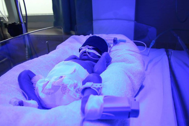 C&aacute;c b&aacute;c sĩ đ&aacute;nh gi&aacute; sức khỏe của b&eacute; đ&atilde; tiến triển