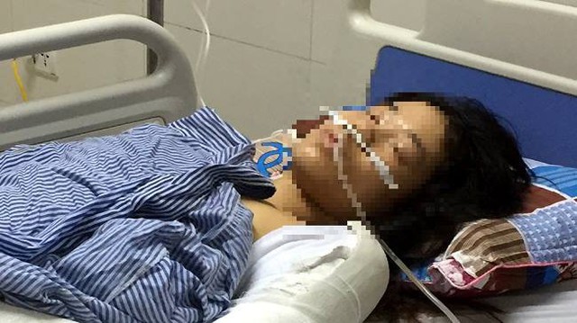 
Chị D. hiện đang được điều trị tại Bệnh viện Đa khoa tỉnh Bắc Giang. Ảnh: NA

