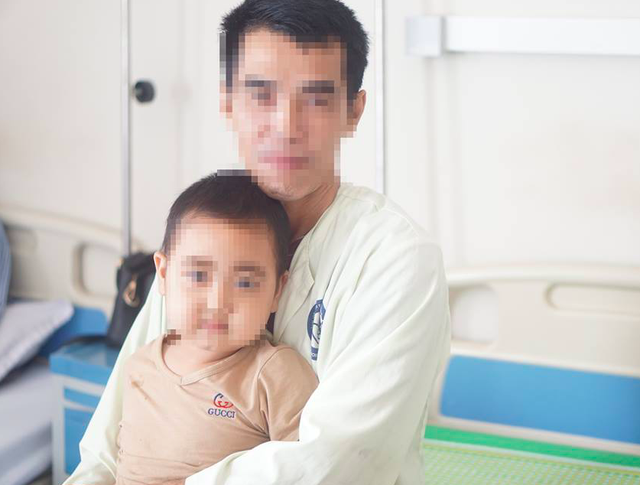 
Bé N.T.D (5 tuổi, ở Sơn La) bỗng nhiên mặt nặng, nổi ria mép sau vài mũi tiêm corticoid ở phòng khám tư. Ảnh: BVCC
