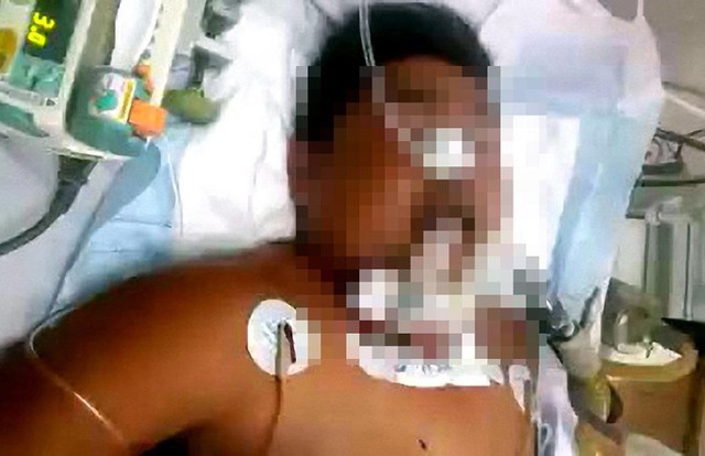 
Nạn nhân Nam lúc được cấp cứu tại bệnh viện
