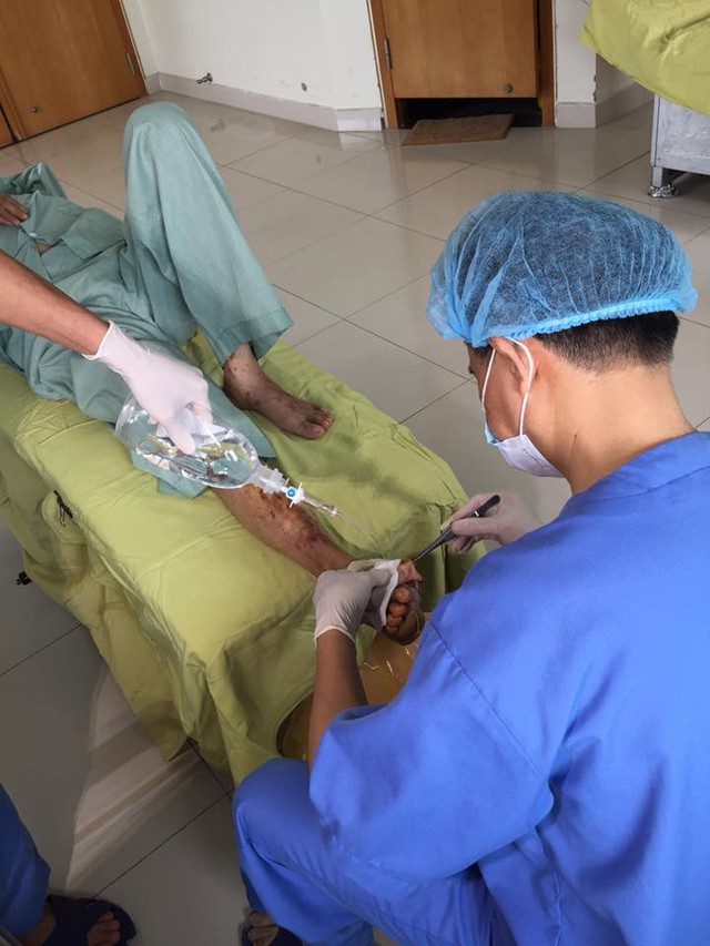Bác sĩ Nguyễn Ngọc Thiện - Phó Trưởng khoa Chăm sóc bàn chân - Bệnh viện Nội tiết TW tiến hành cắt lọc phần hoại tử cho bệnh nhân