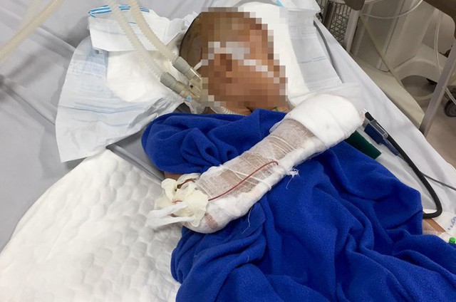 
Bé trai 9 tuổi đang được điều trị tại Bệnh viện Hữu nghị Việt Nam Cuba Đồng Hới. Ảnh: T.A.D.
