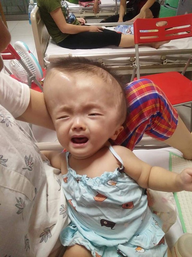
Tình trạng bé Hoài Thương đang ngàn cân treo sợi tóc, liên tục đau đớn, quấy khóc.
