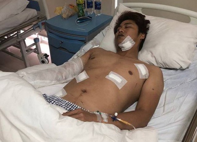 Anh Q. đang nằm điều trị tại Bệnh viện Quốc tế Trung ương Huế.(Ảnh: Công an TPHCM)