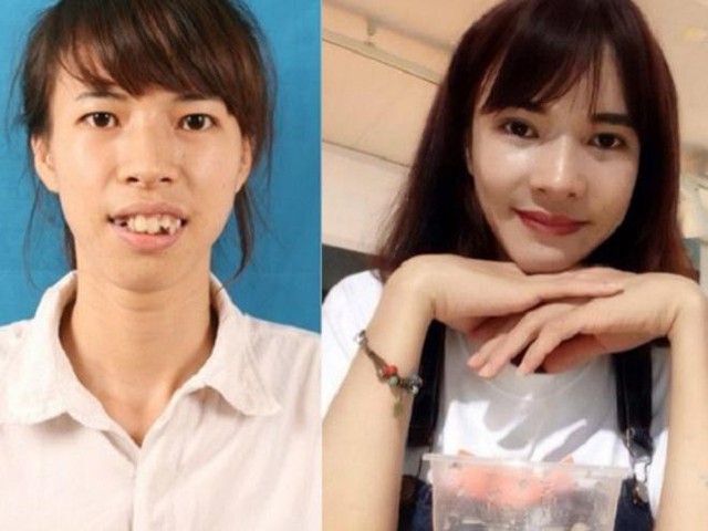 Bùi Thị Dịu từng gặp nhiều khó khăn trong cuộc sống vì ngoại hình kém xinh