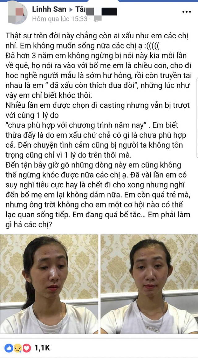 
Gương mặt với nhiều đường nét thiếu hài hoà của cô gái trẻ khiến cô bế tắc, chán sống. Ảnh chụp màn hình, hình ảnh đã được sự đồng ý của người dùng facebook
