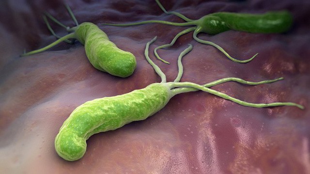 
H. pylori gây ra tình trạng khó tiêu, đầy bụng, viêm nhiễm... làm bệnh dạ dày nặng hơn và là tiền đề của ung thư dạ dày.
