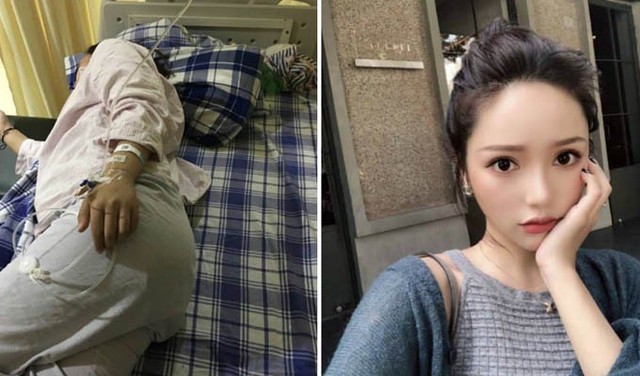 Yang (ảnh trái) đang nằm ở bệnh viện theo dõi sau vụ ẩu đả với blogger thời trang Chen Qing (ảnh phải). Ảnh: Shanghaiist.