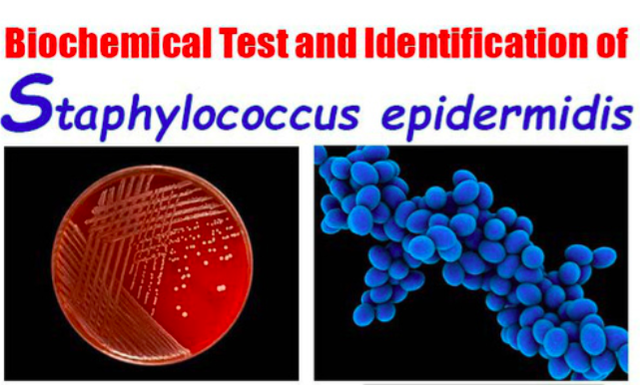 
Siêu vi khuẩn Staphylococcus epidermidis. Ảnh: Microbiology Info
