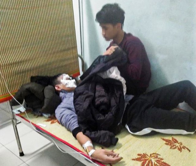 Nam sinh 16 tuổi bỏng nặng vùng mặt sau khi đốt thử xăng. Ảnh: Hoàng Dương.