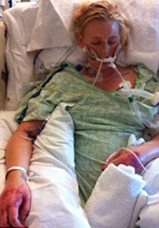 Những hình ảnh về Wasser vào thời điểm mới nhập viện năm 2012. Cô khi đó sốt tới 41 độ C, hai chân bị nhiễm trùng đến thâm đen lại và phải hứng chịu những cơn đau tim liên tục.