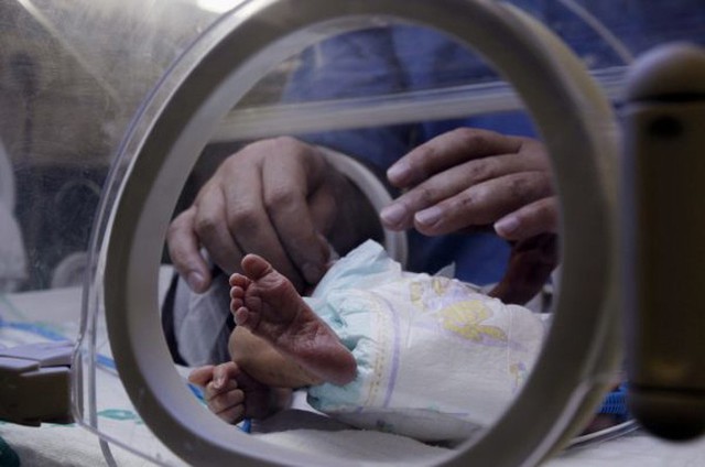 Em bé bị bỏng độ ba và tử vong khi nằm trong lồng tự chế của bệnh viện. Ảnh minh họa: AFP.