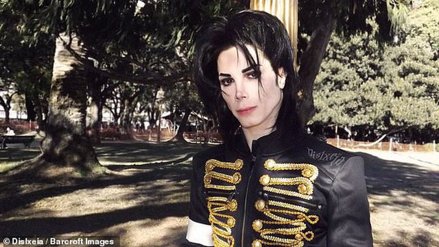Ngoại hình trước đây, và sau khi trải qua 11 ca phẫu thuật thẩm mĩ của fan cuồng Michael Jackson.