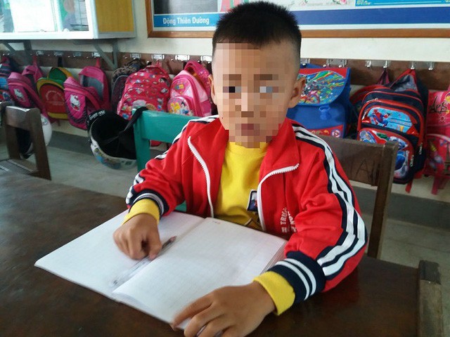 
Cháu Trương Ngọc H., học sinh bị cô giáo tát chảy máu tai.
