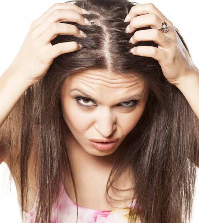 Nếu gặp các biểu hiện này ở tóc, hãy gặp bác sĩ vì rất có thể có điều gì đó không ổn trong cơ thể - Ảnh 6.