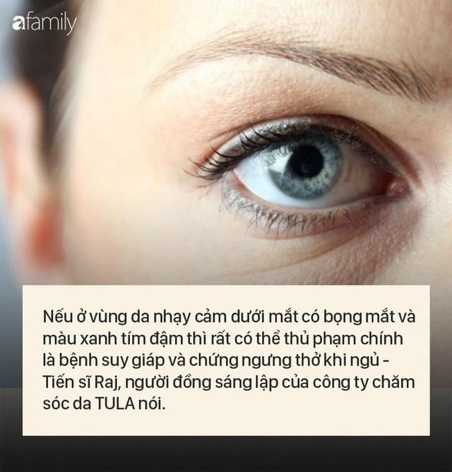 8 dấu hiệu cảnh báo bệnh được “khắc” rất rõ trên khuôn mặt của bạn - Ảnh 4.