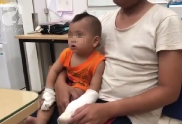 Tai nạn kinh hoàng: Người nhà thử xe máy mới mua, bé trai 1 tuổi bị đứt lìa 4 ngón tay - Ảnh 3.