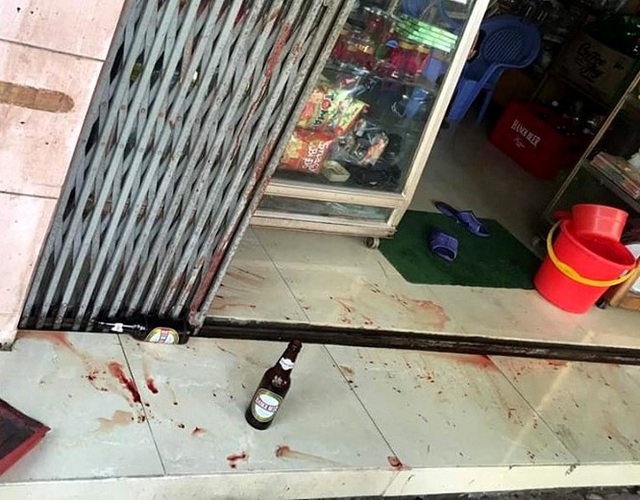 Hải Dương: Đang ngồi uống bia, nam thanh niên bị đâm trúng lưng - Ảnh 1.