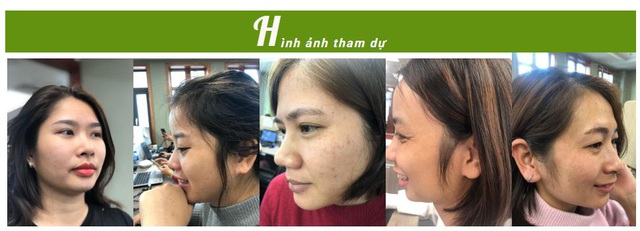 Serum Valentine chính thức khởi động cuộc thi ảnh : “thấu hiểu làn da – gìn giữ nét xuân” - Ảnh 2.