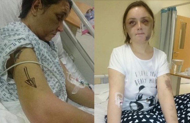 Hình ảnh cô con gái của Kate Dagley tại bệnh viện. Người phụ nữ 46 tuổi bị thương nặng do chủ nhà đánh đập.