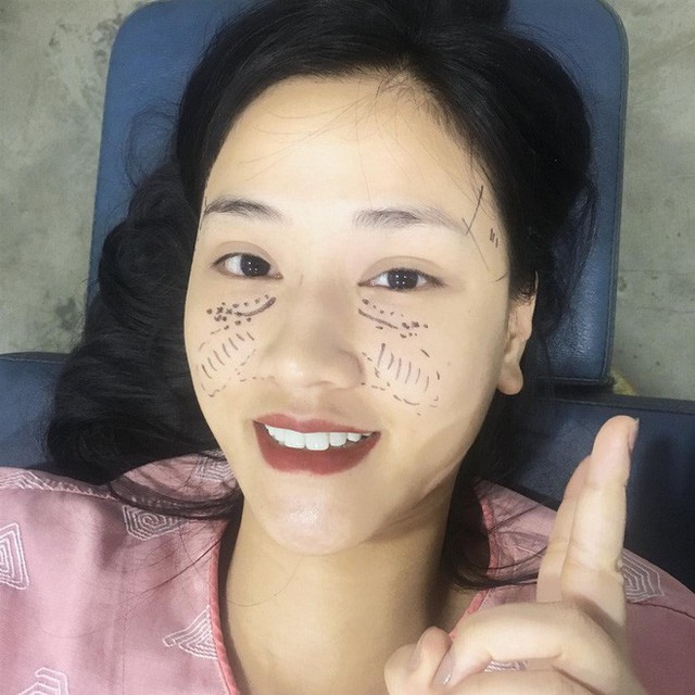 Maya cũng can thiệp dao kéo dù trước đây đã được khen ngợi về nhan sắc.