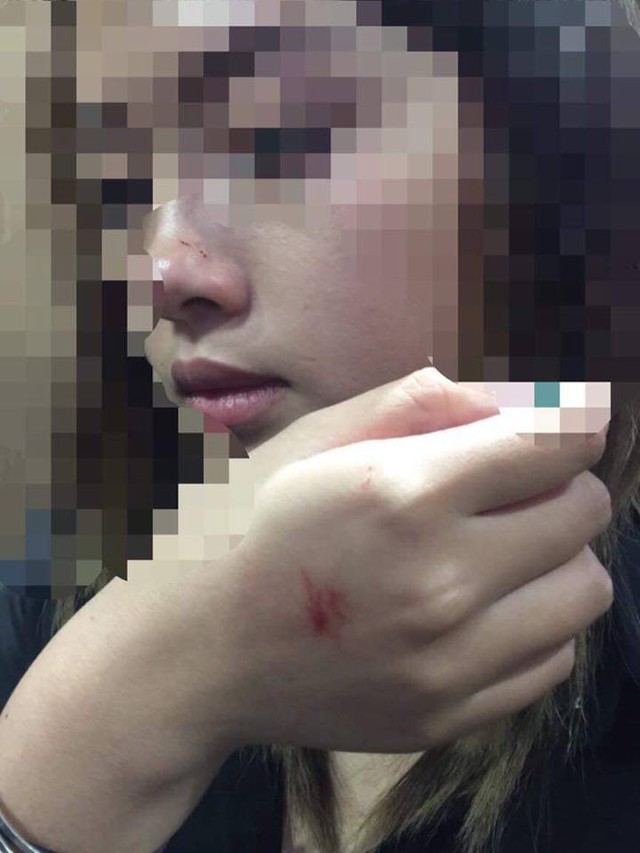 
Cô gái trẻ trong vụ cưỡng hôn trong thang máy ở Hà Nội. Ảnh: TL
