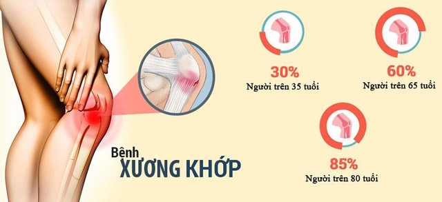 Số người mắc bệnh về xương khớp ngày càng tăng và trẻ hóa