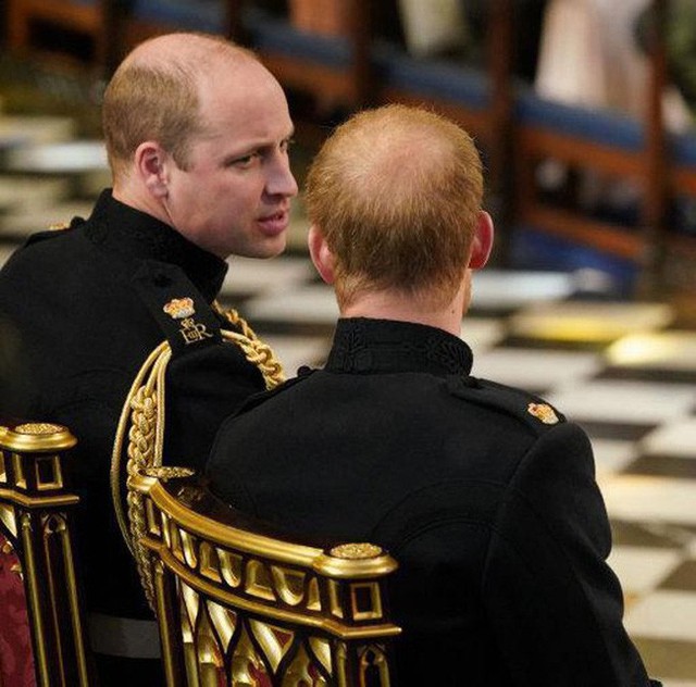 Hai anh em Hoàng tử nước Anh đều bị hói đầu theo di truyền.
