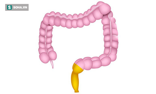 5 dấu hiệu của bệnh viêm trực tràng: Không điều trị sẽ có nguy cơ tiến triển thành ung thư - Ảnh 1.