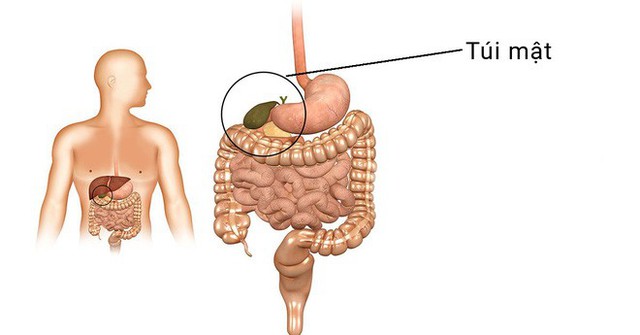 5 loại bệnh vặt không lo chữa, để quá lâu sẽ có nguy cơ tiến triển thành ung thư - Ảnh 2.