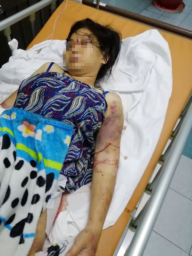 
Nạn nhân Hồ Như Ý bị đánh đập đến sảy thai, đang điều trị tại bệnh viện. Ảnh: Tienphong.vn
