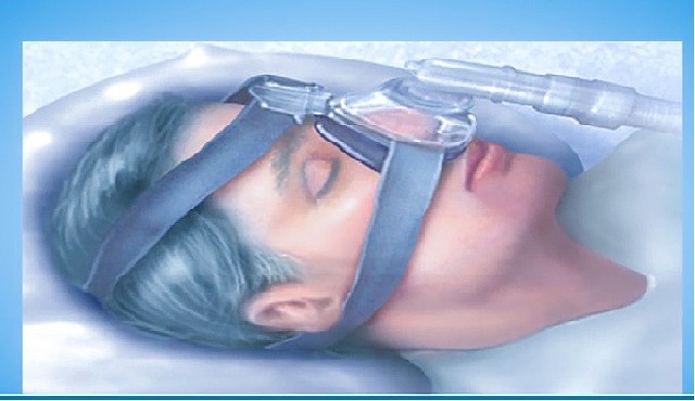 
Bệnh nhân được đeo mặt nạ kết nôi với hệ thống máy giúp duy trì sự thông thoáng cho đường thở, tránh các cơn ngưng thở
