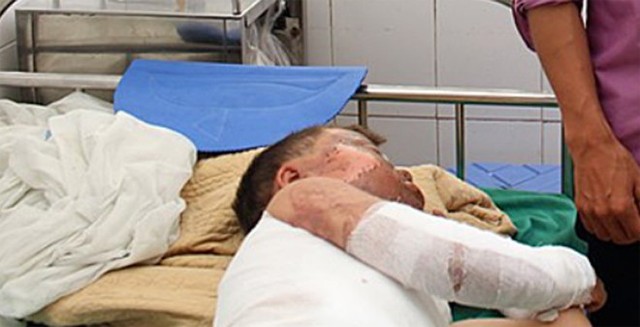 
Bệnh nhi đang điều trị tại BVĐK tỉnh Điện Biên
