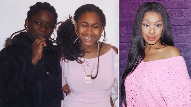 Naomi Oni bị bỏng axit nghiêm trọng sau vụ tấn công. Ảnh: BBC