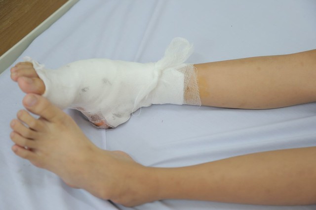 Bé gái ở Hà Nội có bàn chân dị dạng siêu hiếm gặp, 7 năm không tìm ra bệnh  - Ảnh 1.